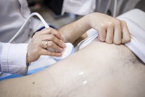 Ultrazvuk renalnih arterija - Poliklinika Cardios Novi Sad